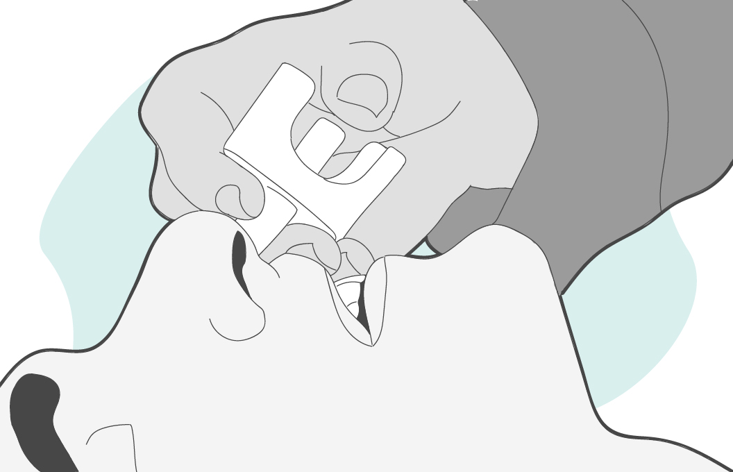 Insert the device into the person's nostril