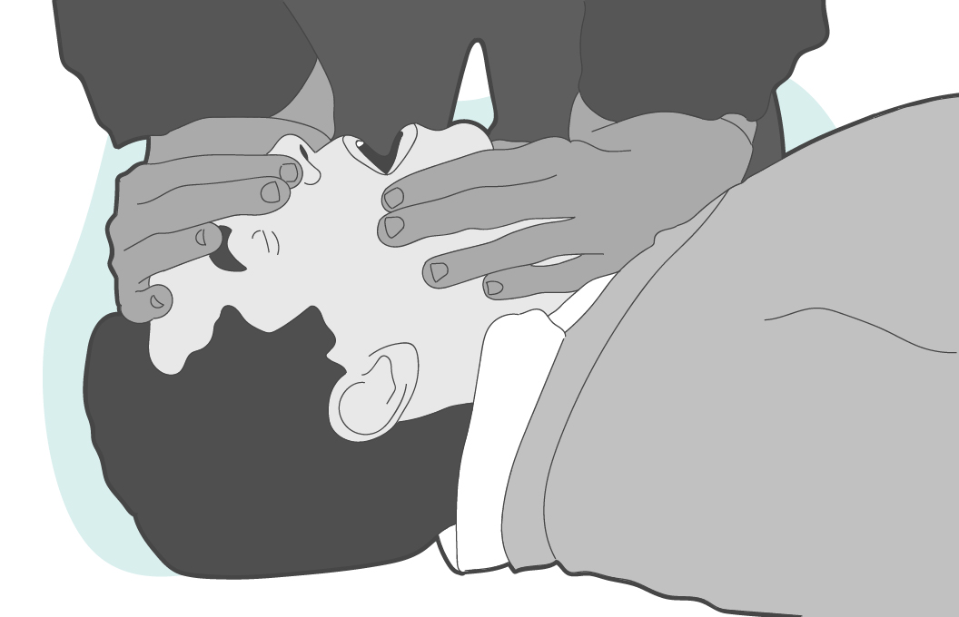 Tilt the person's head back and pinch their nose