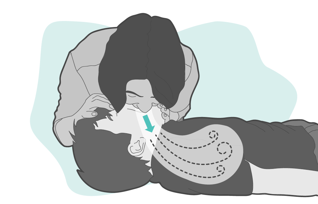 Perform rescue breathing